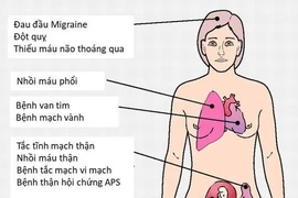 Cẩn thận với hội chứng kháng phospholipid nguy hiểm