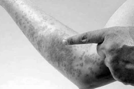 Uống thuốc bổ chuốc thêm bệnh