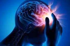 Rối loạn tuần hoàn não có nguy hiểm không?