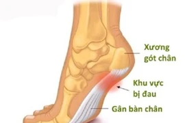  Viêm can gân chân