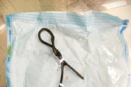 Học theo phim ảnh, trẻ nhét thanh sắt hơn nửa mét vào hậu môn