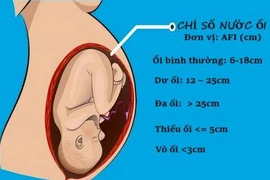 Thiểu ối thai kỳ