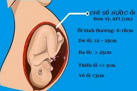 Thiểu ối thai kỳ