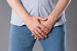 Dậy thì bị giãn tĩnh mạch tinh 