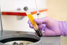 Kháng thể siêu mạnh trong huyết tương người khỏi bệnh Covid-19