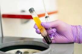 Kháng thể siêu mạnh trong huyết tương người khỏi bệnh Covid-19