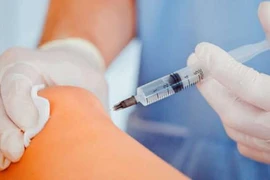 Chỉ định tiêm chất nhờn điều trị thoái hóa khớp