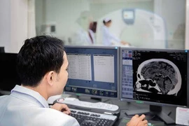 Ung thư dễ xâm nhập màng não