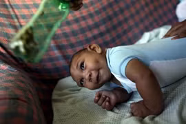 Ấn Độ: Bùng phát dịch do virus Zika