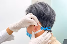 Tắc mạch hoại tử dái tai do tiêm filler trôi nổi tạo tai Phật 