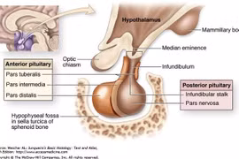 Làm gì khi tình cờ phát hiện u nhỏ tuyến yên?