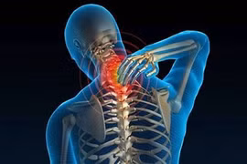Đau vai gáy do bệnh nghề nghiệp