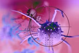 Một liệu pháp điều trị mới, có tiềm năng tiêu diệt u nguyên bào thần kinh đệm