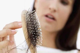 Lý do tóc rụng sau khỏi bệnh COVID-19