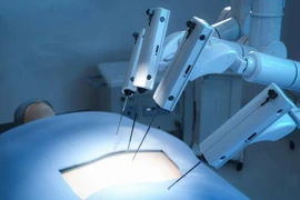 Phẫu thuật bằng robot hiệu quả cao đối với bệnh nhân bị ung thư bàng quang