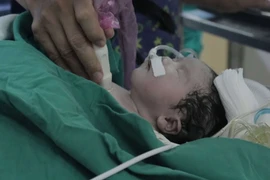 TPHCM: Cứu sống bé gái hơn 1 tuần tuổi bị bệnh tim nguy hiểm