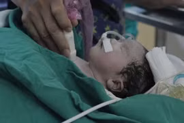 TPHCM: Cứu sống bé gái hơn 1 tuần tuổi bị bệnh tim nguy hiểm