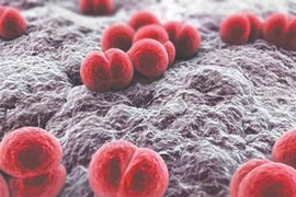 Hai trẻ nhập viện do nhiễm não mô cầu, 1 tử vong, 1 phải cắt chi