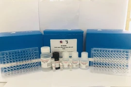 Kit chẩn đoán suy giáp bẩm sinh