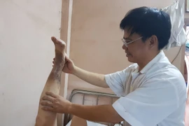  Nhiều bệnh nhân suy giãn tĩnh mạch được cứu chữa bởi bàn tay diệu kỳ của người thầy thuốc lừng danh