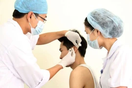 Cấy chỉ  trên loa tai: Công nghệ vi cấy ghép của Việt Nam