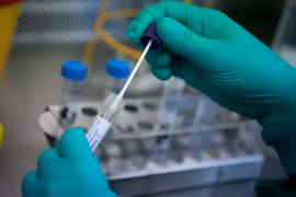 Sẽ huy động khối xét nghiệm ngoài công lập tại TP.HCM