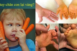Tưởng vàng da do tăng caroten lành tính nào ngờ mắc bệnh nguy hiểm