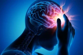 Chế độ ăn phòng ngừa thiếu máu não 