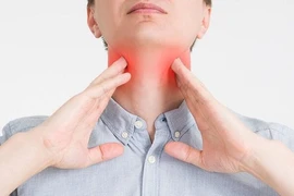 Viêm amidan ở người lớn và những điều bạn cần biết