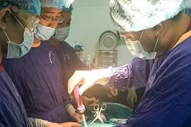 Bơm xi măng sinh học có bóng cứu “gù” cho bệnh nhân bị xẹp thân đốt sống