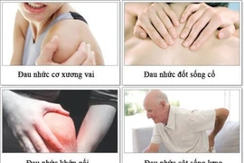  Kỹ thuật đặc biệt khống chế đau nhức xương khớp