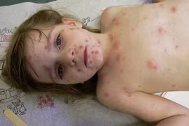 Con mắc bệnh mới hối hận