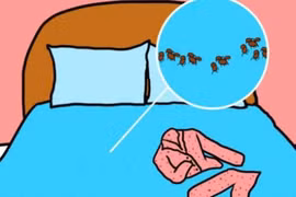 Tác hại của việc mặc đồ ngủ quá 2 ngày