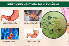 Điểm mặt nguy cơ cao gây ung thư dạ dày