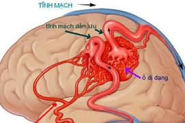 Mắc bệnh này, bạn có nguy cơ đột tử trước tuổi 40