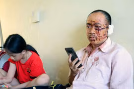 Nạn nhân xe Phương Trang: Người văng khắp nơi, la hét thất thanh