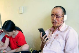 Nạn nhân xe Phương Trang: Người văng khắp nơi, la hét thất thanh