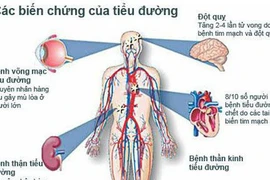  Nguyên nhân dẫn tới bệnh tim mạch ở người đái tháo đường