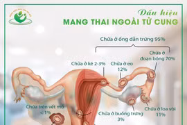 Dấu hiệu mang thai ngoài tử cung