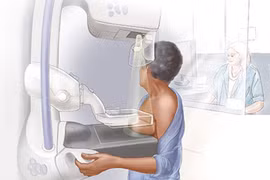 Ngộ nhận ung thư tự khỏi và những cơ hội điều trị bị bỏ qua