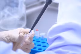 Bộ Y tế công bố 5 ca tử vong do Covid-19, 3 ca không có bệnh lý nền