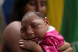 Phát hiện trường hợp nhiễm virus gây bệnh đầu nhỏ tại Đà Nẵng