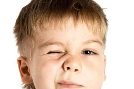 Trẻ nháy mắt có nên lo lắng?