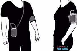 Tăng huyết áp lưu động đơn độc