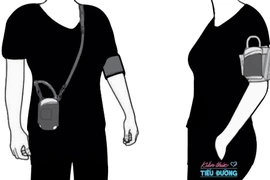 Tăng huyết áp lưu động đơn độc