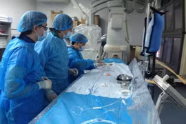 Can thiệp nội mạch điều trị dị dạng động tĩnh mạch não