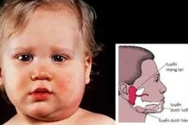 Làm gì khi bị viêm tinh hoàn do quai bị