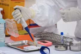 Bộ Công an: Máy xét nghiệm Covid-19 bị nâng giá 4,7 tỷ đồng