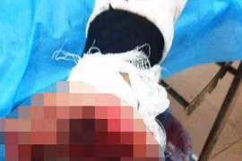 Vừa sạc pin vừa dùng điện thoại, tử thần gõ cửa