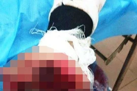 Vừa sạc pin vừa dùng điện thoại, tử thần gõ cửa